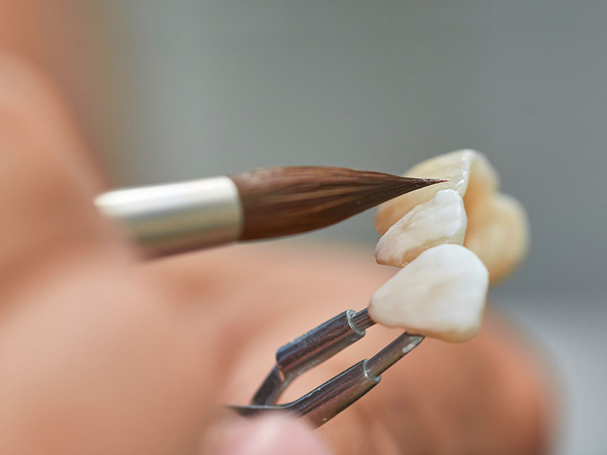 Tetri's Smile dental laboratory craftsmanship